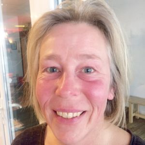 BeautyLight gegen Juckreiz bei Schuppenflechte