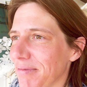 BeautyLight für mehr Vitalität und Attraktivität