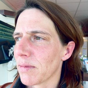 BeautyLight für mehr Vitalität und Attraktivität